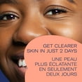 thumbnail image 2 of Exfoliant anti-acné au charbon de Bioré, 2 of 7