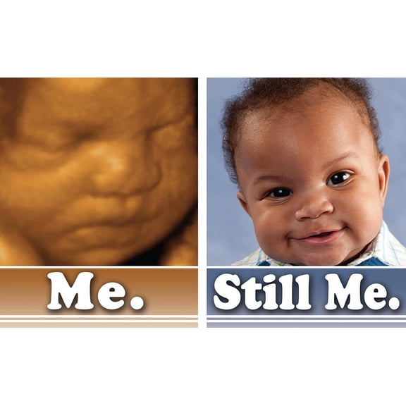 Me....Still Me Pro-Life Bulletin (Pack of 100)