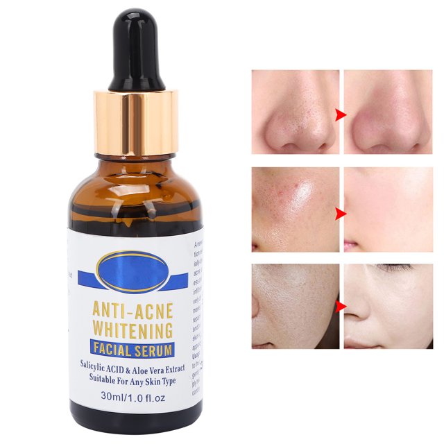 Sero Hidratante Antiacne Facial Sero Tratamiento de Acné Solución de Suero Calmante de la Piel 30 ml