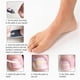thumbnail image 5 of Parches de corrección de uñas encarnadas Perfecl herramienta para el cuidado de los pies, 5 of 8