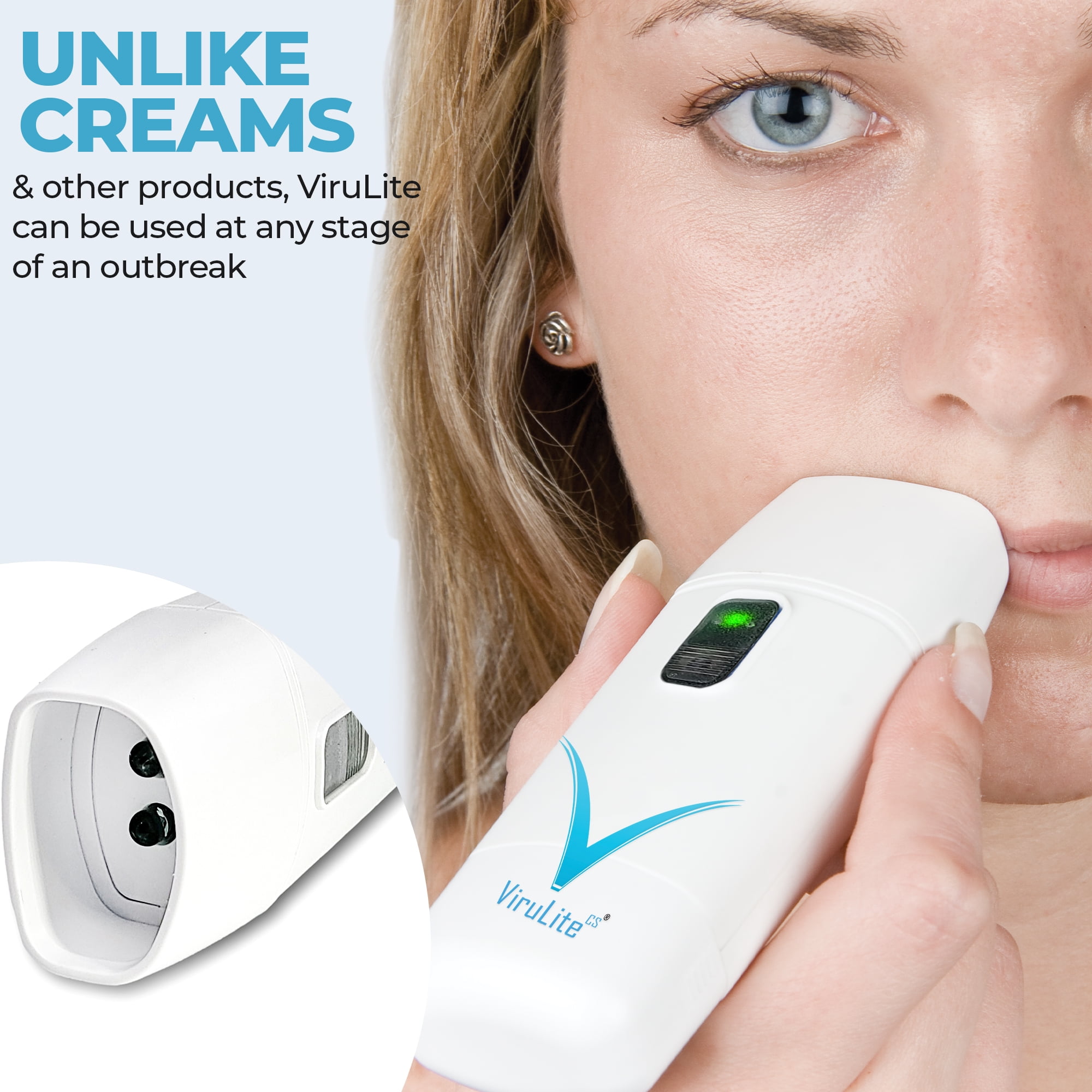 ViruLite Cold Sore Light Therapy Device – Clinically Proven Red Light Treatment for Cold Sores and Fever Blisters – Drug-Free, Portable, Fast Relief