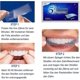 thumbnail image 4 of z Teeth Whitening, 28 Bleaching Teeth Whitening Stripes, White Teeth Bleaching Non Sensitive, Teeth Whitening Stripes, All Teeth Stains Quickly Re, 4 of 4