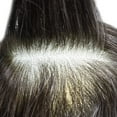 thumbnail image 5 of LYRICAL HAIR Toupee for Men Indian Human Hair Replacement System All Lace Mens Toupee French Lace Hairpieces for Man Bleached Front Knots Mens Hair Piece Unit, 5 of 7