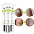 thumbnail image 4 of 1/2x EFERO Nail Repair ence Remove Onychomycosis Serum Fgal Nail Treatment S9L3, 4 of 7
