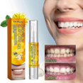 thumbnail image 1 of Propolis Gum Care Gel, Propolis Gum Gel, Propolis Teeth Regrowth Dental Gel, Gum Gel New Arrival, 1 of 5