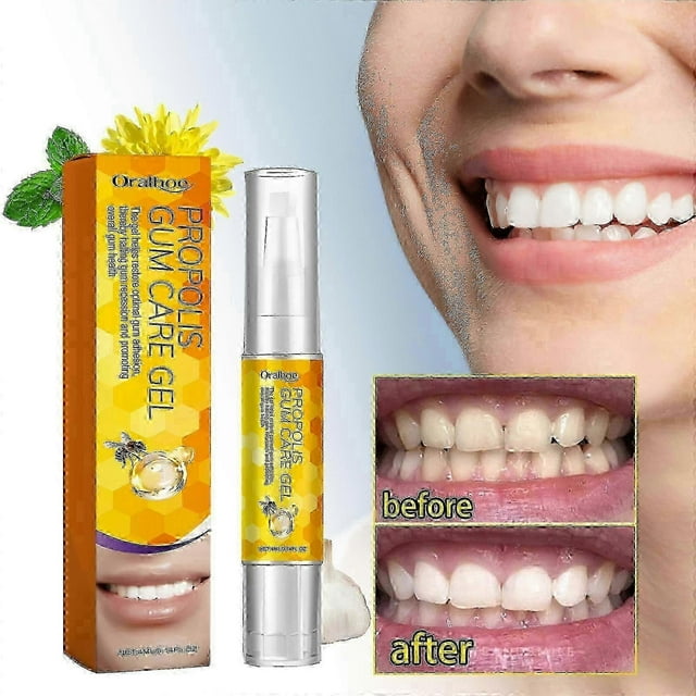 Propolis Gum Care Gel, Propolis Gum Gel, Propolis Teeth Regrowth Dental Gel, Gum Gel New Arrival