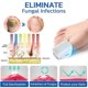 thumbnail image 2 of New Nail Fungus Cleaning Laser Device, Blue Light Nail Therapy For Damaged Discolored Thick Toenails Fingernails, Effective Rechargeable Nail F, 2 of 5