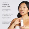 thumbnail image 2 of Jan Marini Skin Research Benzoyl Peroxide Acne Treatment Lotion 5% - 4 Fl Oz, 2 of 8