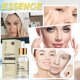 thumbnail image 4 of Esencias para el cuidado de la piel con glutatión, hidratante, nutritivo, iluminador, reduce las líneas finas y las arrugas y repara la piel, 30 ml Autorización, 4 of 6