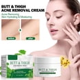 thumbnail image 4 of BUY 2 SAVE 10%!Maojin Acné corporal, extractos de plantas para el acné de la piel son suaves y no contienen acné, cuidado suavizante de la piel, suave y no irritante, 3.99fl.oz/110g, 4 of 9
