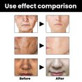 thumbnail image 4 of Facial essence Moisturizing and Nourishing Facial Skin Improving Dark Skin essence, 4 of 5