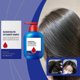 thumbnail image 5 of Anti Dandruff Shampoo Selenium Disulfide Oil Control Shampoo Dandruff Itching Hair Care Refreshing Oppose Cleansing For Men And Women, 5 of 5