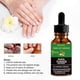 thumbnail image 3 of Multi-Purpose Ginger Infused Nail Repair Solution for Daily Use, 3 of 5