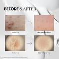 thumbnail image 4 of Suero CICA Reedle Shot 50 VT Cosmetics Asiático con Ácido Hialurónico y Exosomas, 4 of 7