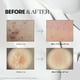 thumbnail image 4 of Suero CICA Reedle Shot 50 VT Cosmetics Asiático con Ácido Hialurónico y Exosomas, 4 of 7