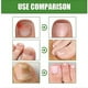 thumbnail image 2 of 1-3X Nail shield ANTI-FUNGAL STICK Nailshield Anti Fungal Stick, Monsalife Nail Shield Anti Fungal Stick, 2 of 5