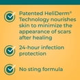 thumbnail image 3 of Pomada antibiótica Neosporin Original, 15 ml, protección durante 24 horas, 3 of 7