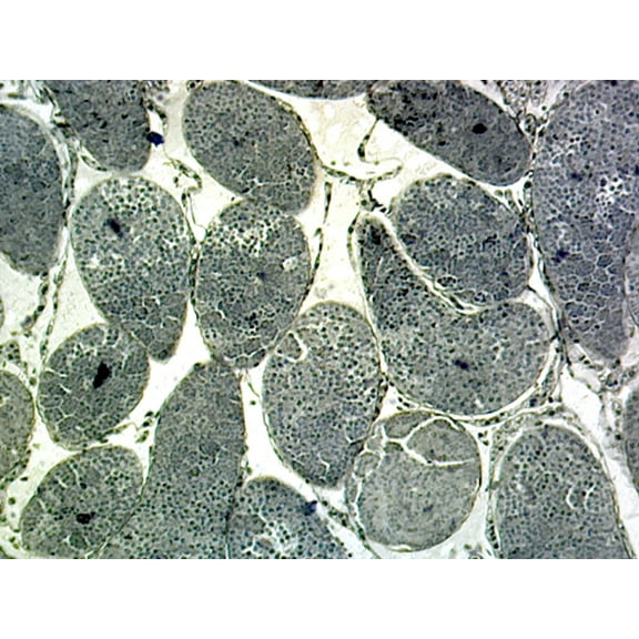 Grasshopper Meiosis; Section by Go Science Crazy