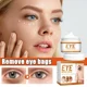 thumbnail image 2 of Suaviza las arrugas, crema rodante para ojos, bolsas para los ojos, ojeras, crema firme antihinchazón debajo de los ojos, hidratante, blanqueamiento, cuidado de la piel, 2 of 5