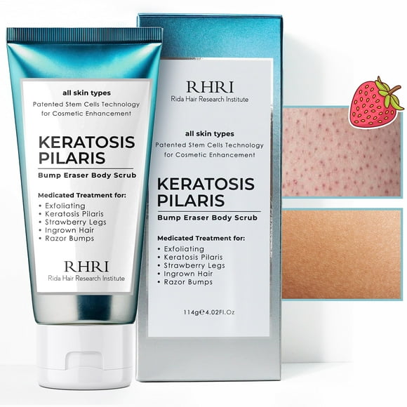 Exfoliante corporal KP Bump Eraser, queratosis pilaris, tratamiento para mujeres