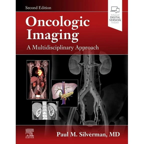 Oncologic Imaging: A Multidisciplinary Approach, (Hardcover)