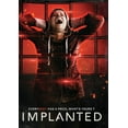 thumbnail image 1 of Implanté, 1 of 1