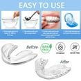 thumbnail image 2 of XIRQI 6 Pcs Mouth Guard for Clenching Teeth at Night,Silicone Mouth Guard Night,Night Guards, 2 of 5