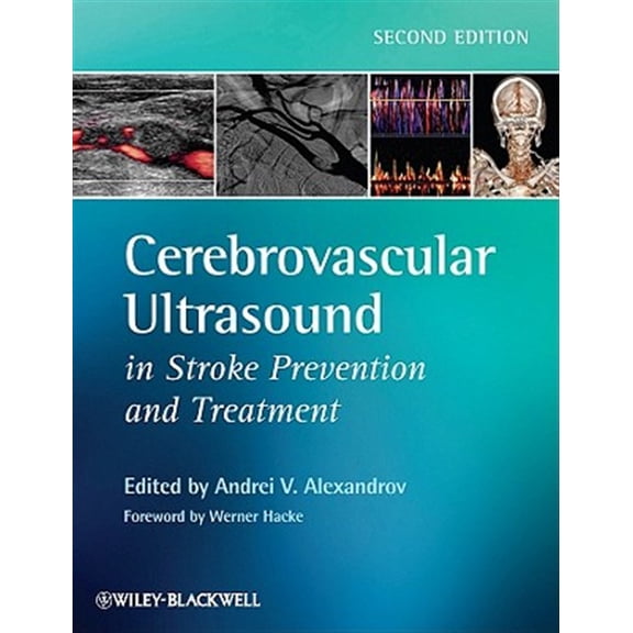 Pre-Owned Cerebrovascular Ultrasound in Stroke Prevention and Treatment (Hardcover)