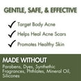 thumbnail image 3 of Body Acne Reducing Natural Lotion with Neem & Manuka for Acne Relief & Soothing Hydration, 8 oz by LatherGreen, 3 of 6