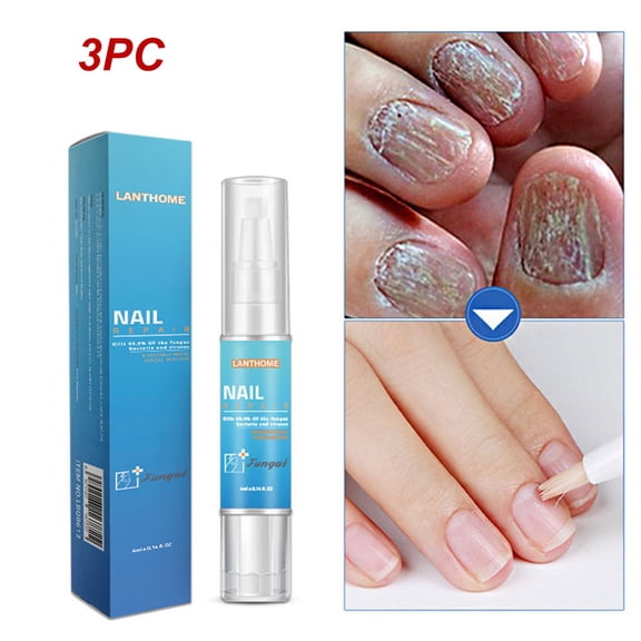Komiseup Nail Care Pen, Nail Treatment Pen, Nail Strengthener Protector For Damaged Skin Thin Nail, Smooth, Healthy-Looking Nails