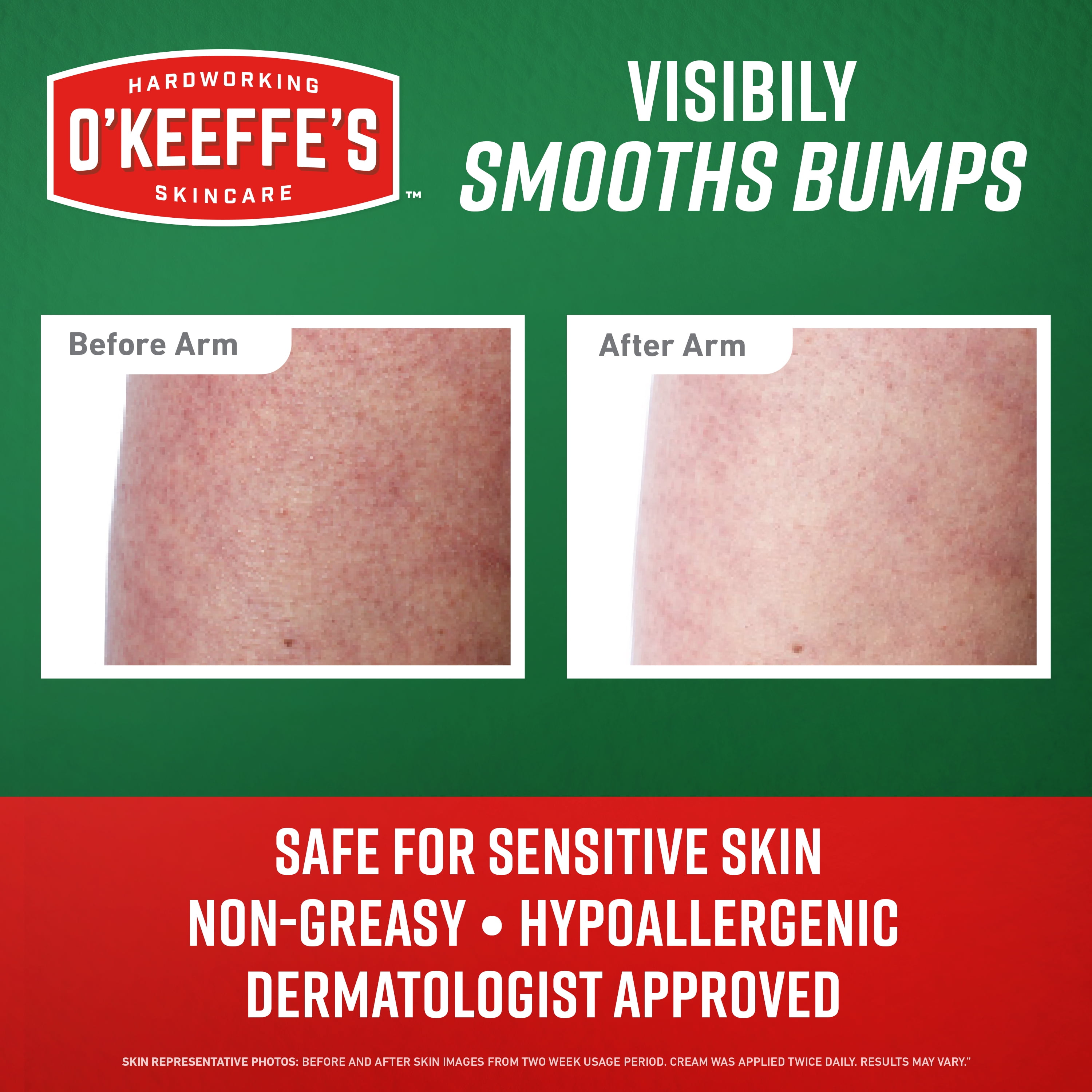 O'Keeffe's 7oz Skin Repair Rough & Bumpy Unscented Body Cream