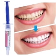 thumbnail image 3 of Dental Etching Agent 37% Phosphoric Acid Etch Gel Syringe Teeth Care Kit Tools New, 3 of 5