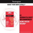 thumbnail image 2 of Parches Para acné y espinillas Neutrogena Stubborn 10 parches, 2 of 5