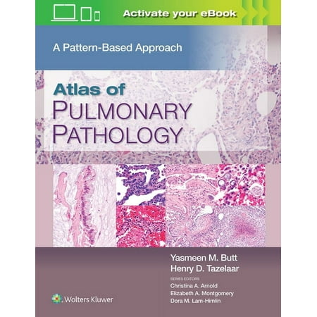 UPC: 9781496397553 | Atlas of Pulmonary Pathology: A Pattern Based Approach (Hardcover)