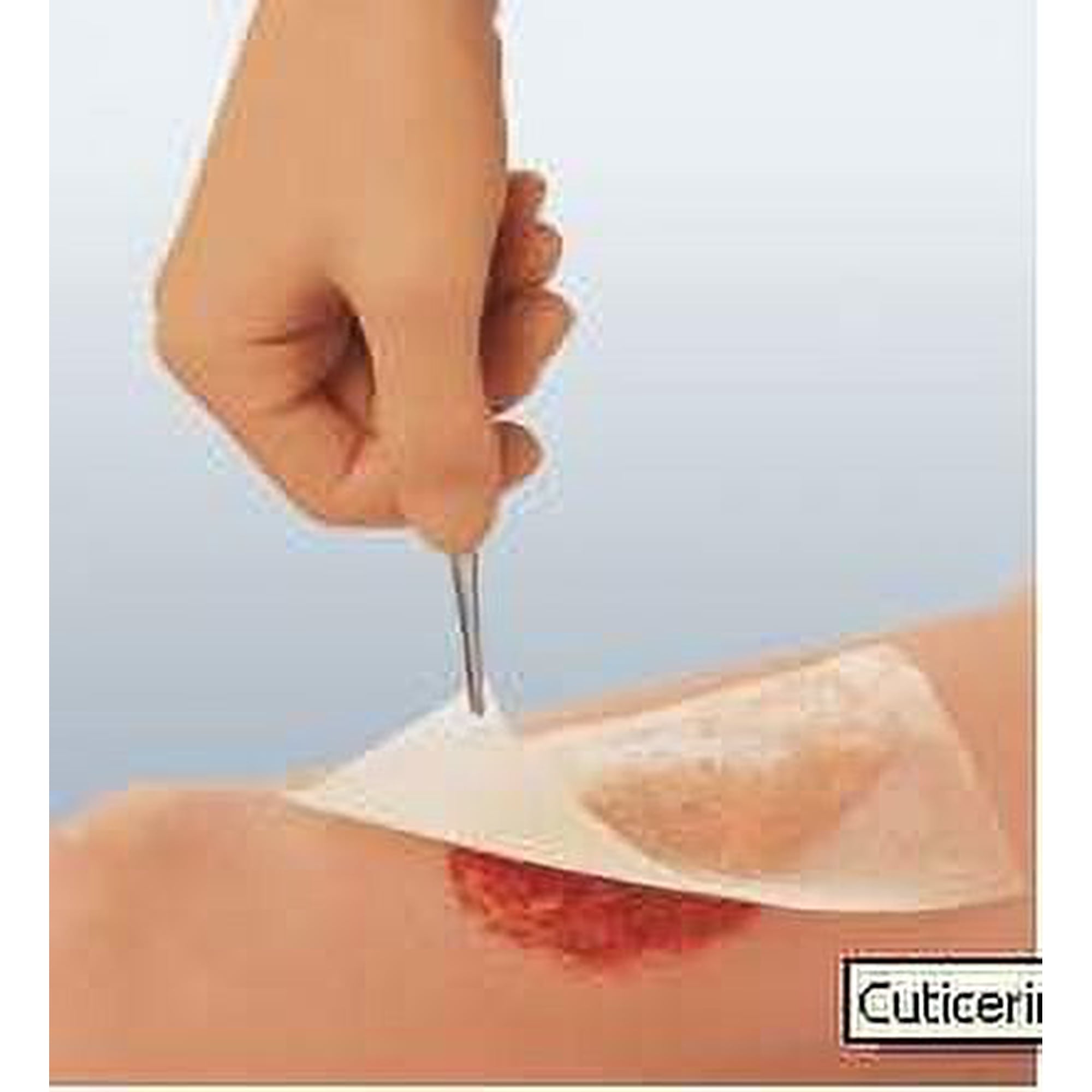 Cuticerin Gauze Dressing 3" x 8" [Box of 50]