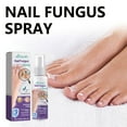 CzestPyake Nail Spray Fresh Foot Deodorant Spray Stinky Feet Reduce