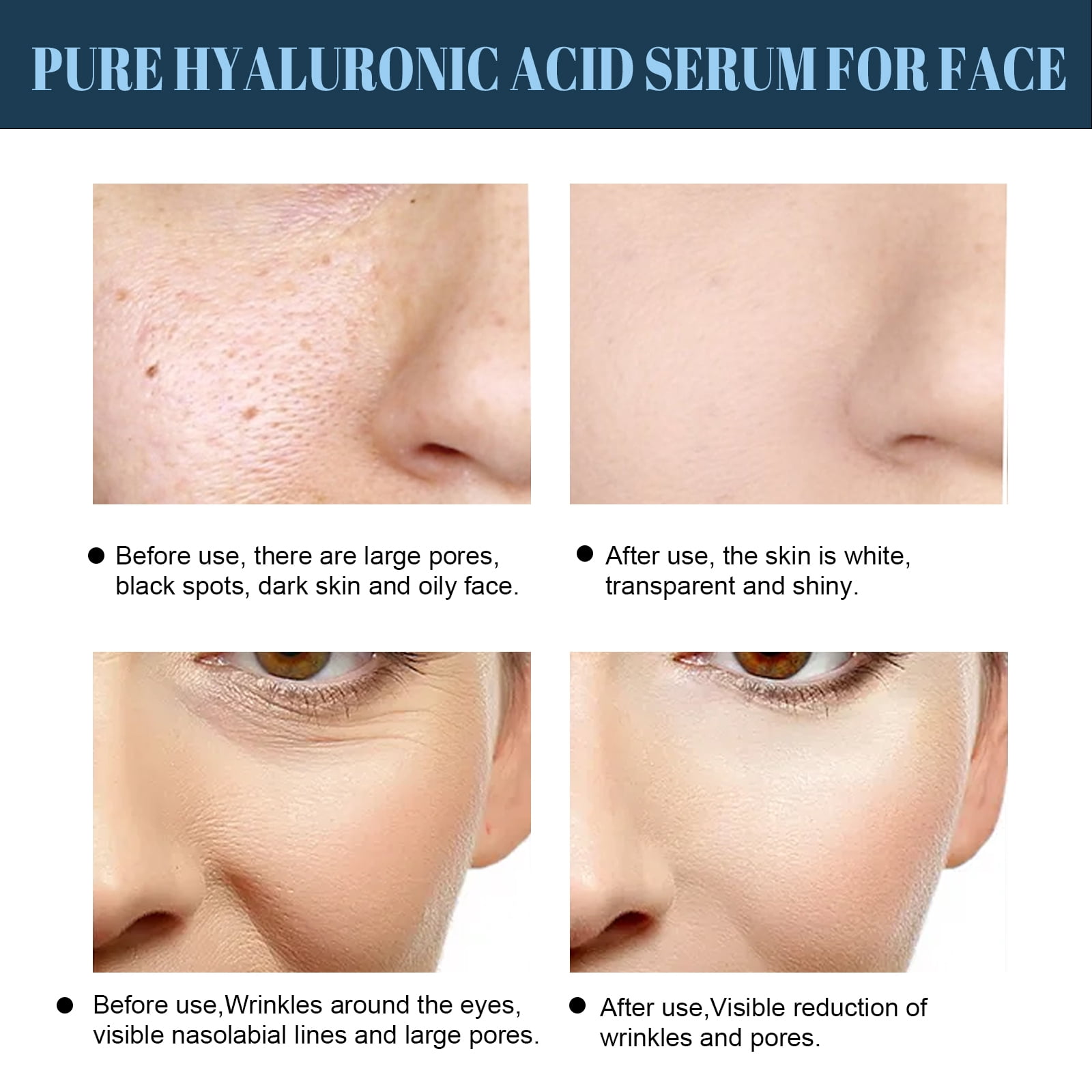 Alvantor Protein Line Anti-Wrinkle Hydrating Treatment, Soluble Collagen Thread for Skincare, 60pcs