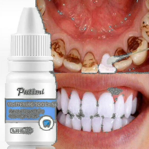 Teeth Whitening Serum Oral Hygiene Whitening Gel Removes Plaque Stains Cleaning Bleaching Tooth Whitening