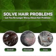thumbnail image 4 of Anti-Dandruff Shampoo,Shampoo for Scalp Prone to Folliculitis, Dermatitis, Dandruff, Itchy and Flaky Scalp -440206975001, 4 of 4