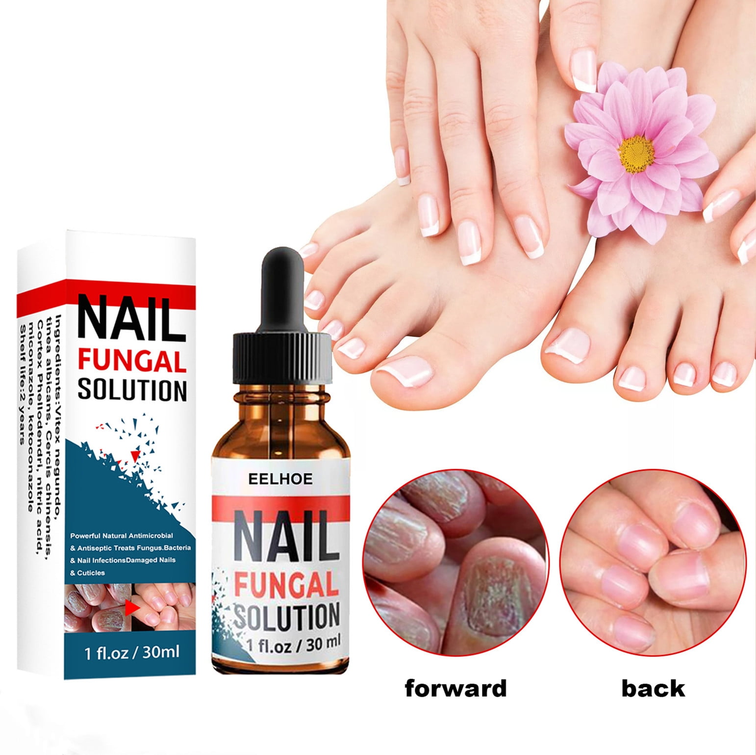 NAILS SERUM FOR NAIL GROWTH & REPAIR, FUNGAL INFECTION, ANTI-INFECTIVE  REMOVAL PARONYCHIA ONYCHOMYCOSIS at Rs 899.00 | बरतन, किचनवेयर - Smart  Zone, Pune | ID: 2853156390391