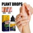 thumbnail image 1 of 10ml Nail Care Liquid Repairs Soft Nails On Hands And Feet, Thickens And Brightens Nails, Moisturizes And Cleans Nail Care, 1 of 5