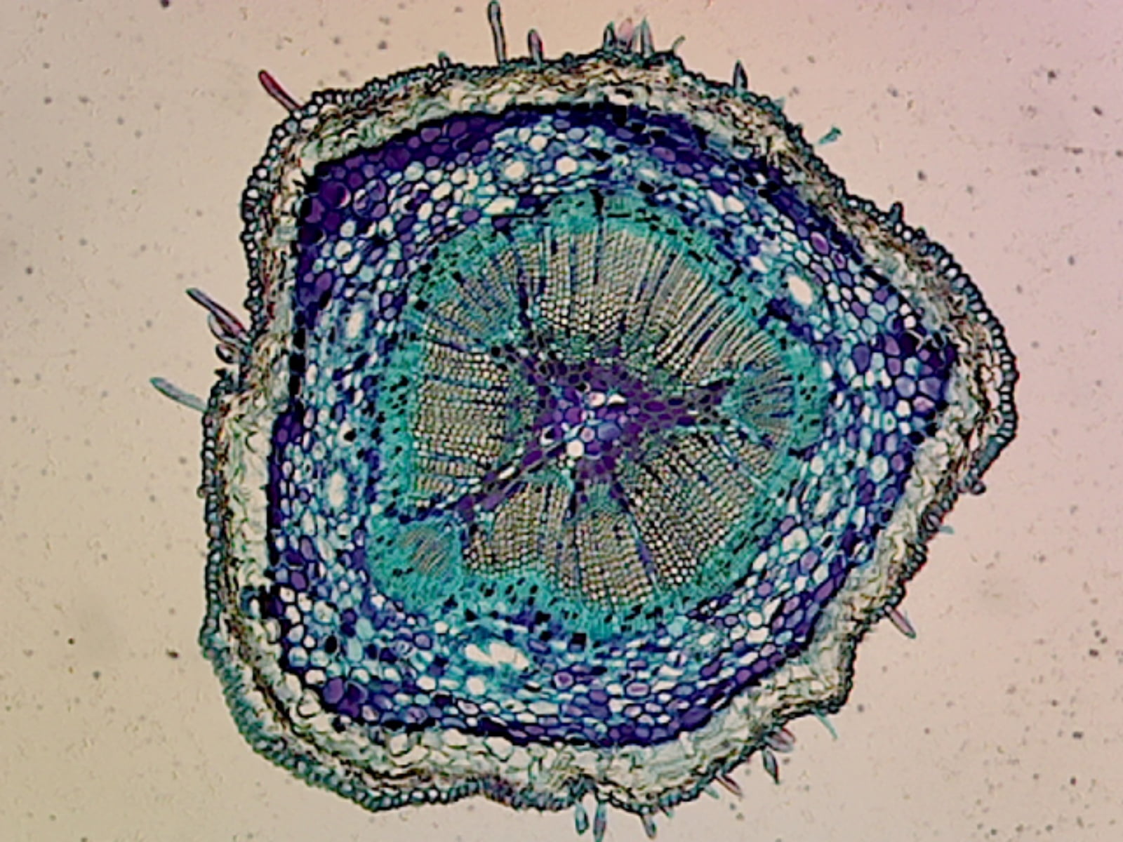 Pine (Gymnosperms) Ovulate Cone; Showing Axis Cone With Ovuliferous