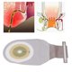 thumbnail image 5 of Bolsas de Colostomía Desechables, Fácil de Cambiar Mantenga la Bolsa de Ostomía Portátil Seca 10 Paquete A Prueba de Fugas PARA ELSO DE VIJES, 5 of 7
