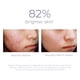 thumbnail image 5 of Sérum de vitamina C Derma E 10% con niacinamida 30 ml, 5 of 7
