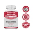 thumbnail image 3 of Acne-Tame with Vitamin B5, Vitamin A, Selenium & L-Cysteine 30 Count Tablets, 3 of 3