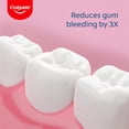 thumbnail image 2 of Cepillo de dientes Colgate PerioGard Ultra Soft Gum Expert, paquete de 4, 2 of 6