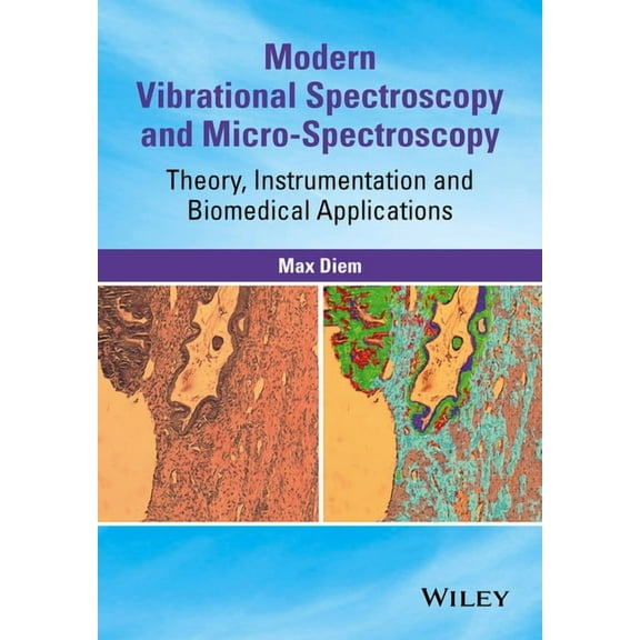 Modern Vibrational Spectroscopy and Micro-Spectroscopy: Theory, Instrumentation and Biomedical Applications, (Hardcover)