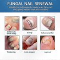 thumbnail image 3 of Effective Solution for Nail Fungus on Hands & Feet, Repairs Discolored Nails, Shields Thick or Damaged Nails, 3 of 5