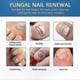 thumbnail image 3 of Effective Solution for Nail Fungus on Hands & Feet, Repairs Discolored Nails, Shields Thick or Damaged Nails, 3 of 5