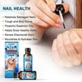 thumbnail image 5 of Nail Fungus Treatment,sumifun New Bright Nail Suit Series Gray Nail Care, 5 of 5